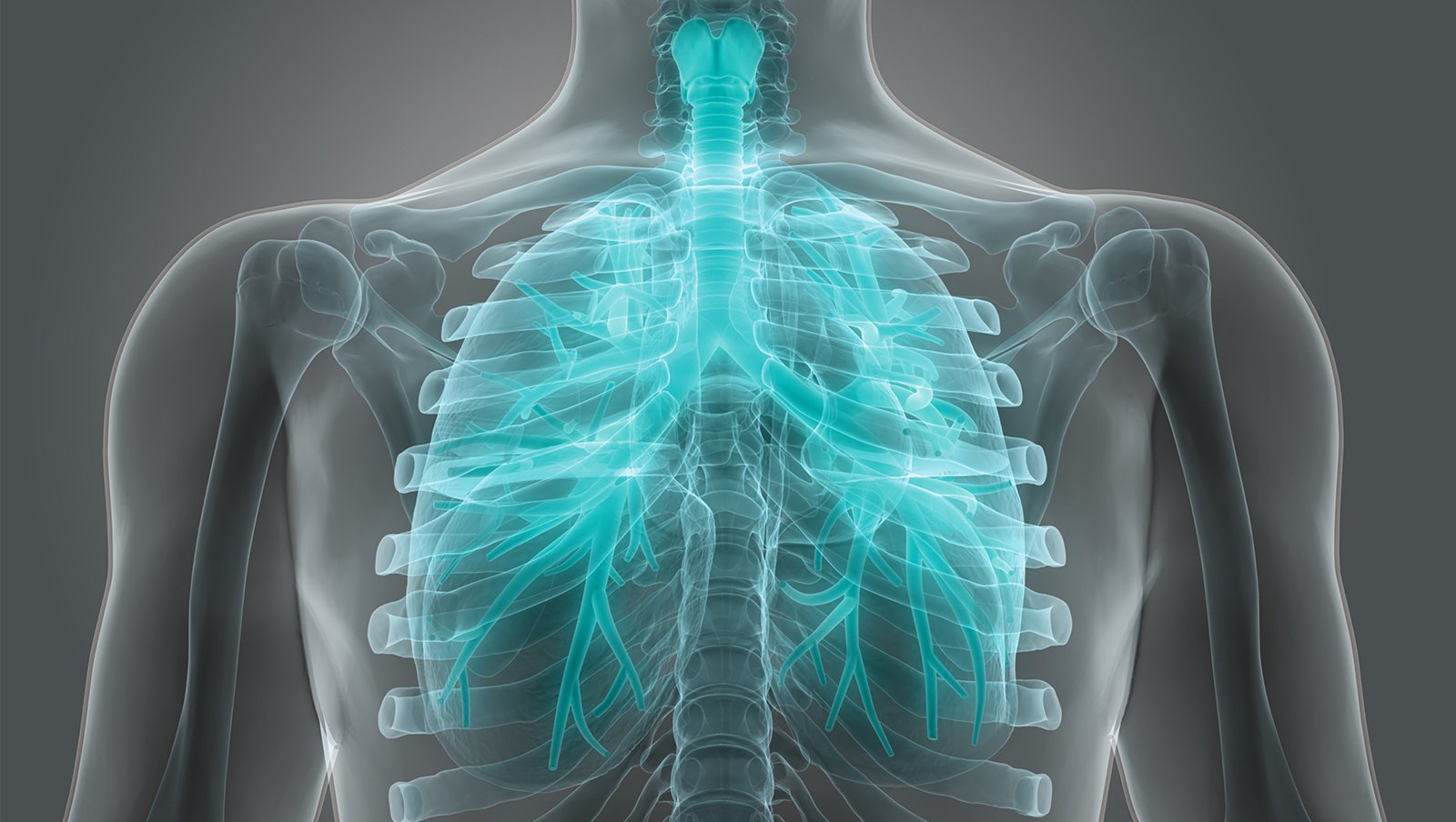 Zapalenie płuc wywołane przez Pneumocystis jirovecii u pacjentów z rozlanym chłoniakiem z dużych komórek B leczonych R-CHOP
