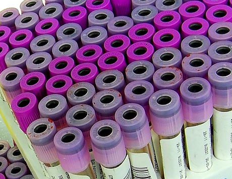 Mezenchymalne komórki macierzyste z pępowiny nową szansą terapeutyczną