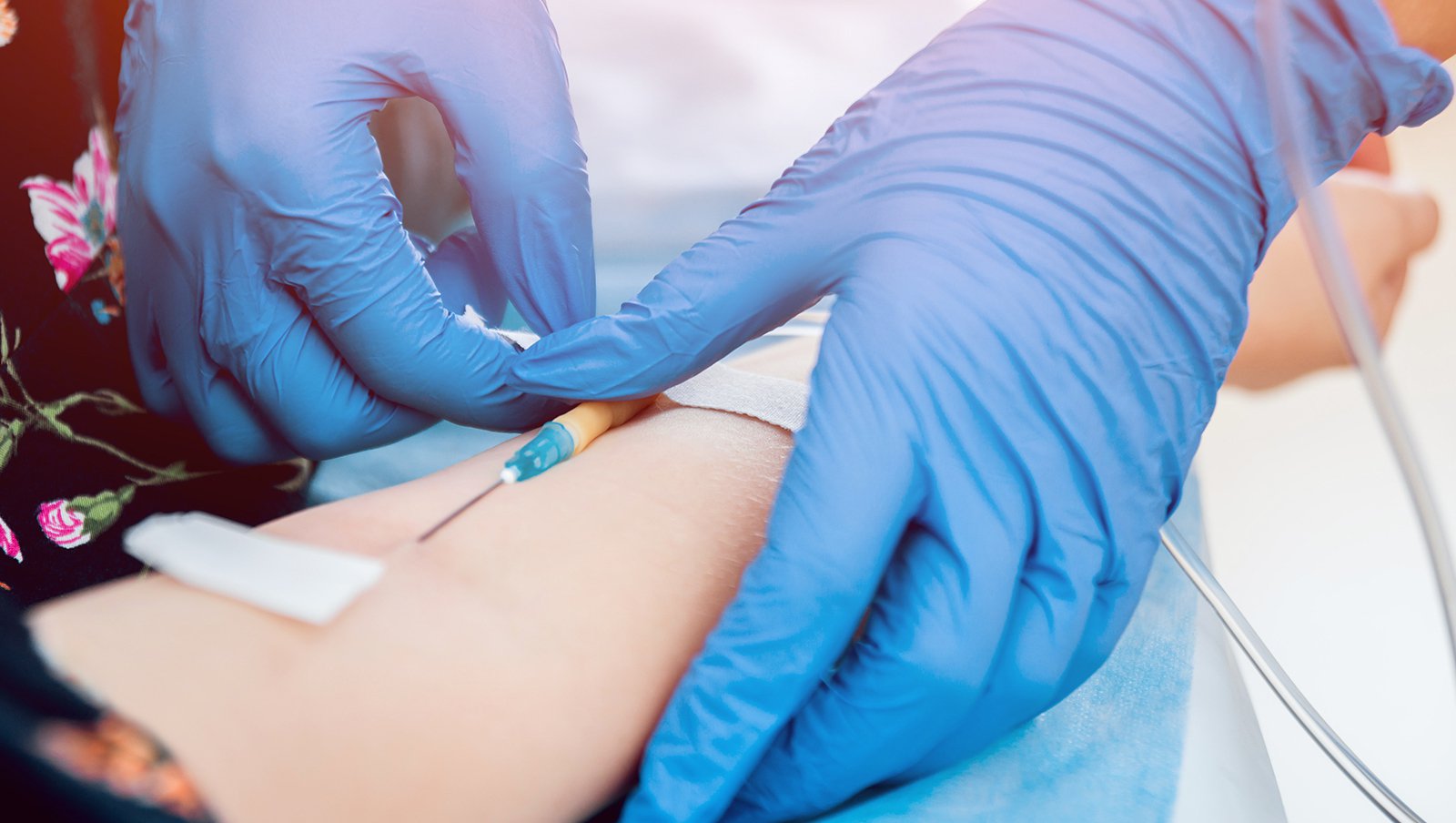 Anemia nie zawsze taka oczywista – dożylne podanie preparatów żelaza w praktyce