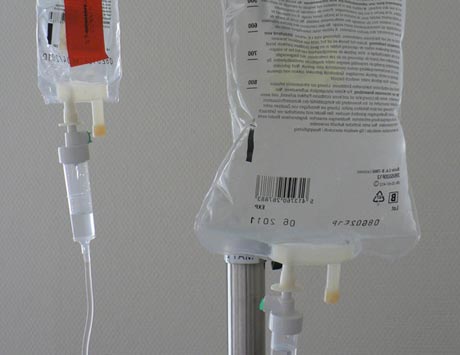 Problemy dokanałowego podawania cytostatyków w profilaktyce i leczeniu zajęcia ośrodkowego układu nerwowego u chorych na ostrą białaczkę limfoblastyczną