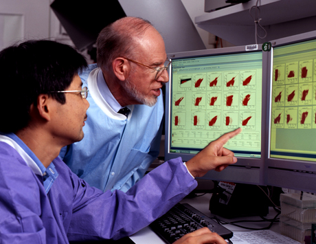 Nowy indeks prognostyczny dla chorych na DLBCL poddanych ASCT