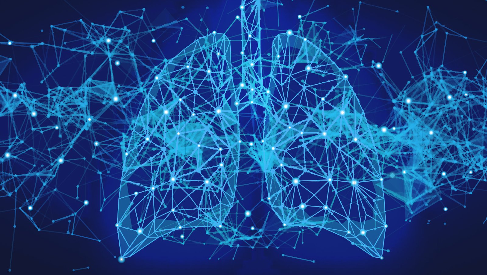 Przedłużony przebieg zapalenia płuc związanego z COVID-19 u pacjenta ze zmniejszeniem liczby komórek B po leczeniu rytuksymabem