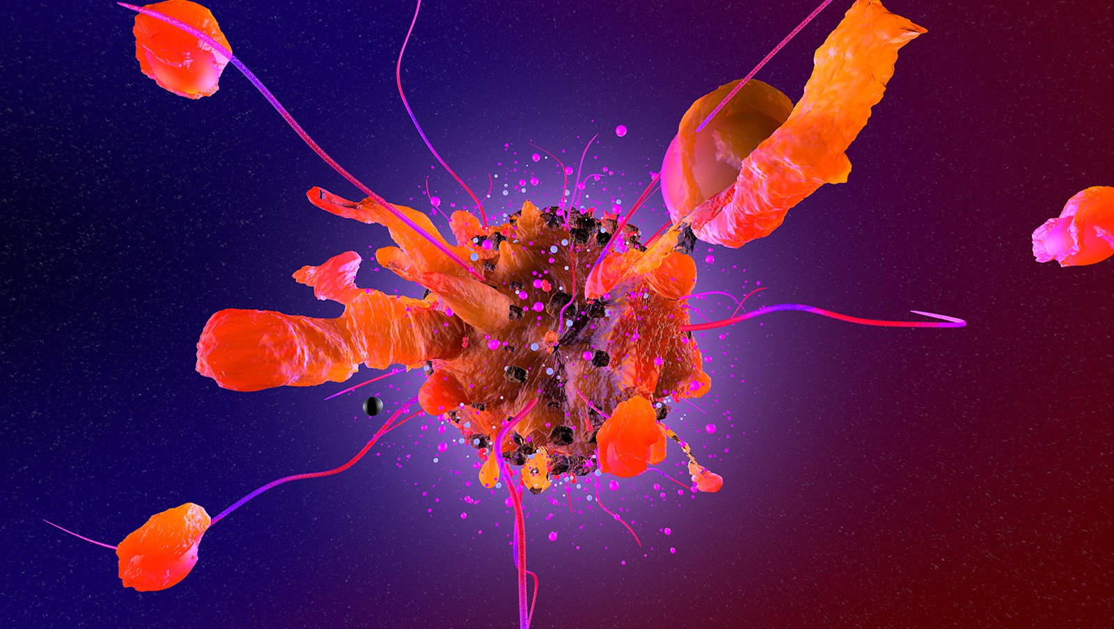 Nowy inhibitor BTK – zanubrutinib w leczeniu przewlekłej białaczki limfocytowej