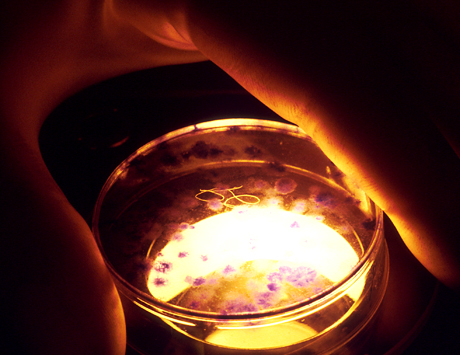 Badanie molekularne (IgH-qPCR)  krwi obwodowej w monitorowaniu MRD w szpiczaku plazmocytowym