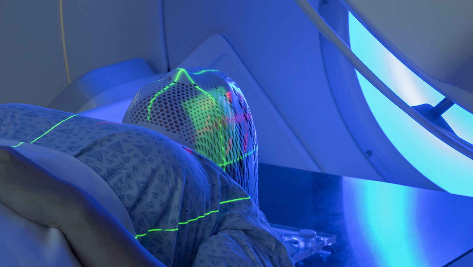 Radioterapia we wczesnym stadium chłoniaka MALT żołądka: lepsze przeżycie bez zwiększonego ryzyka śmierci sercowej