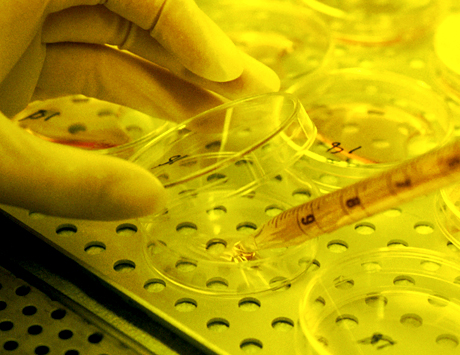 Diagnostyka inwazyjnych zakażeń grzybiczych – rekomendacje ECIL