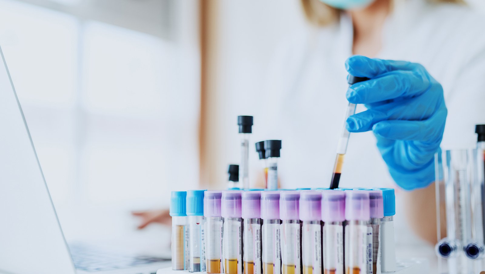 Selinexor w skojarzeniu z deksametazonem w leczeniu szpiczaka - pozytywna decyzja...