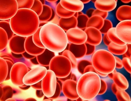 Wyzwania diagnostyczne w łagodnej hemofilii A