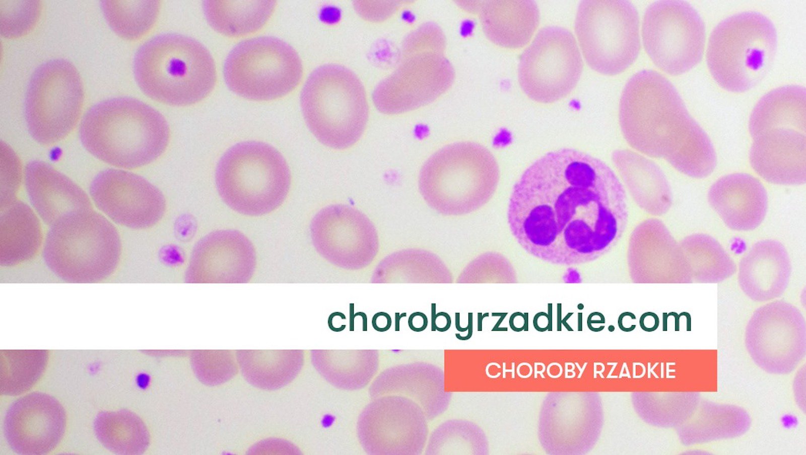 Rusza kampania edukacyjna o chorobach rzadkich