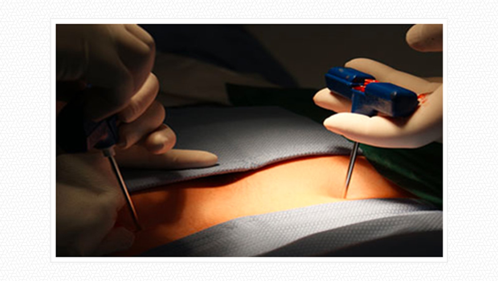 Międzynarodowa Konferencja Naukowo-Szkoleniowa: Transplantacja komórek krwiotwórczych w leczeniu szpiczaka i innych dyskrazji plazmocytowych, 11-12.10.2019, Poznań