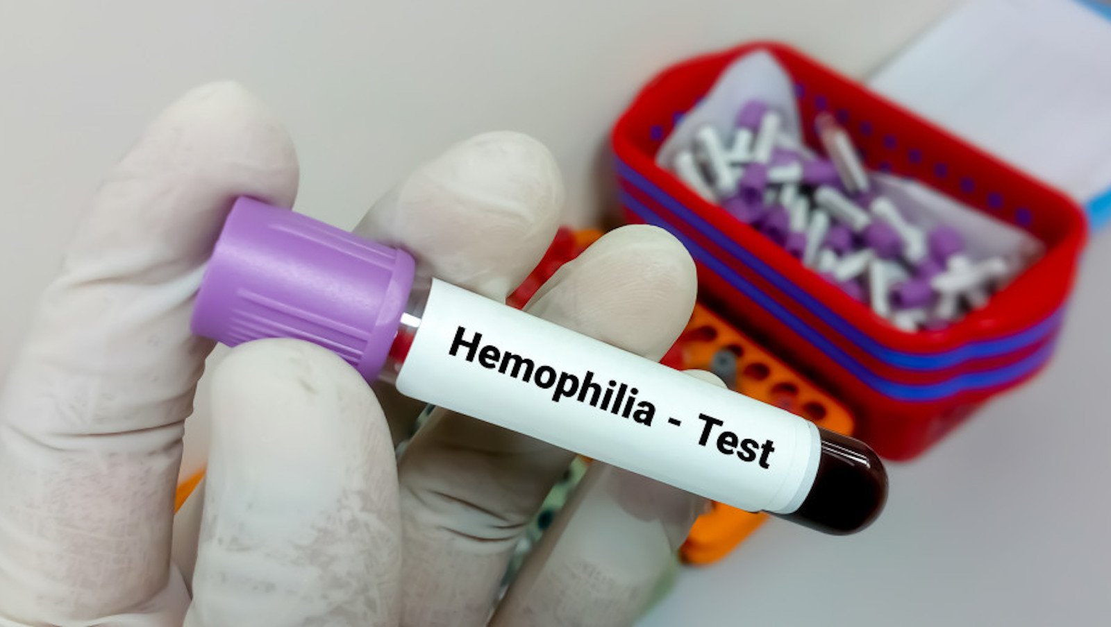 Hemofilia. W Polsce brakuje swobody w doborze terapii