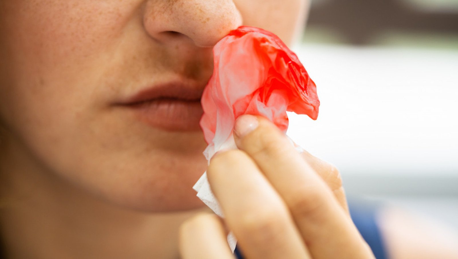 Hemofilia. Zdaniem chorych konieczna jest lepsza opieka w ośrodkach leczenia, telemedycyna i dostawy domowe