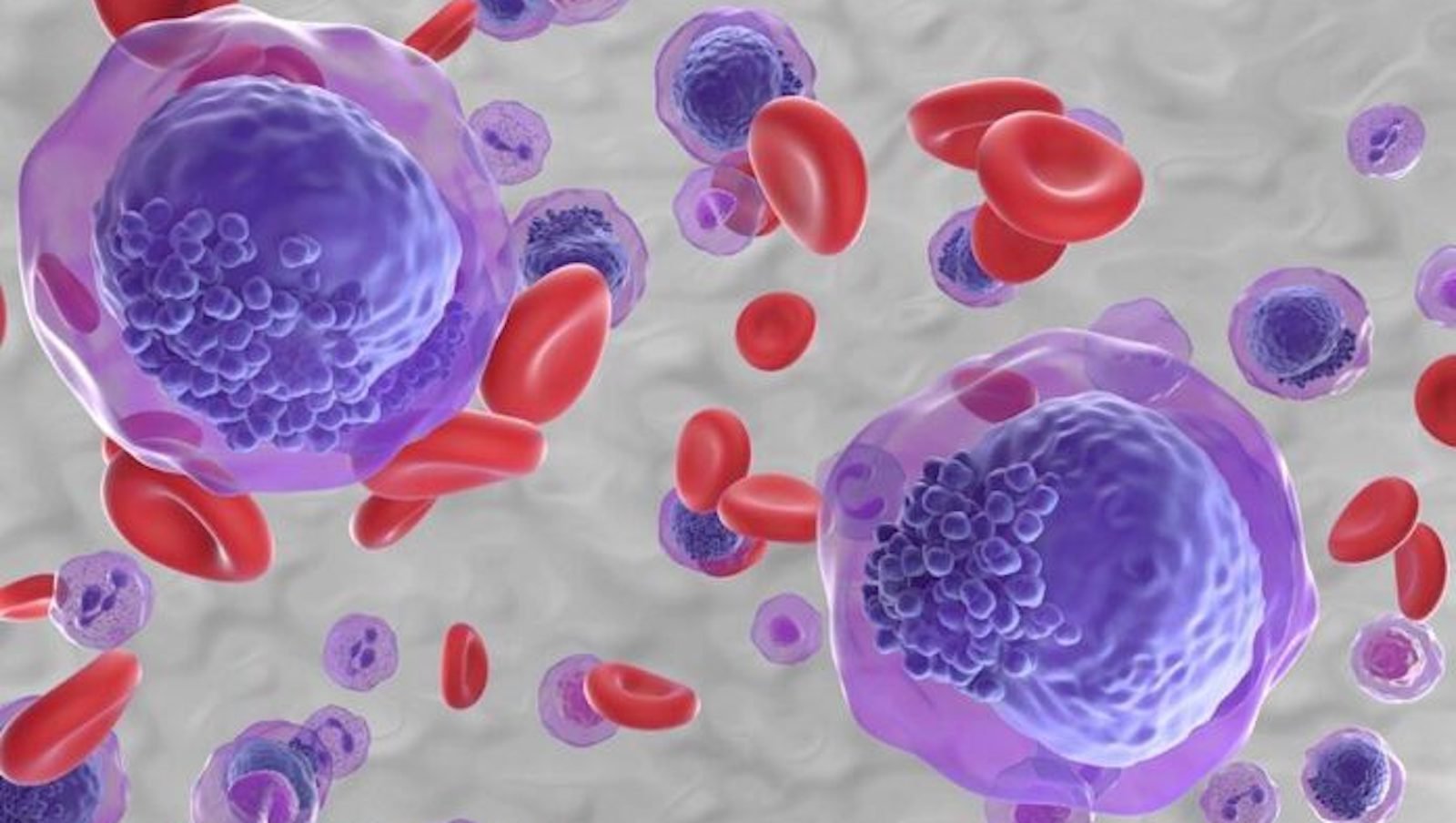 Prof. Lidia Gil: To absolutnie przełomowe leczenie