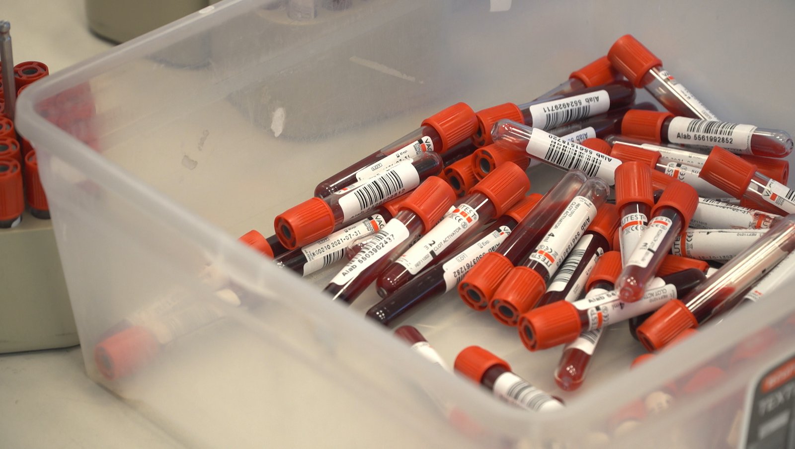 W Polsce co roku diagnozuje się 800 przypadków ostrej białaczki szpikowej. Chorzy mają dostęp tylko do jednego nowoczesnego leku