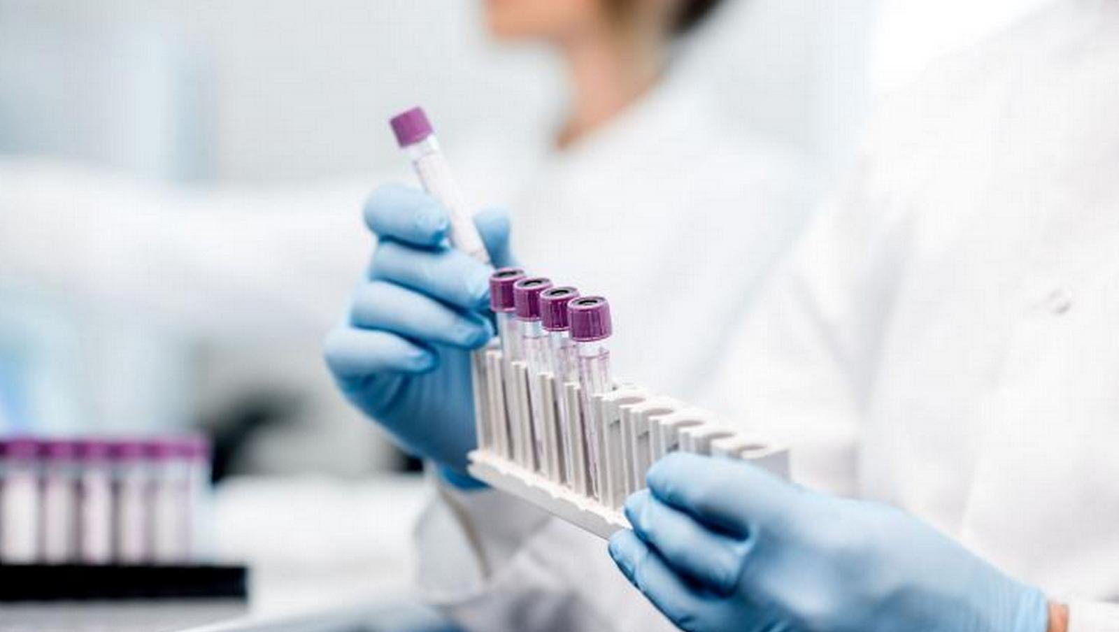 Nowatorskie badania hematoonkologiczne z udziałem Instytutu Genetyki Człowieka PAN
