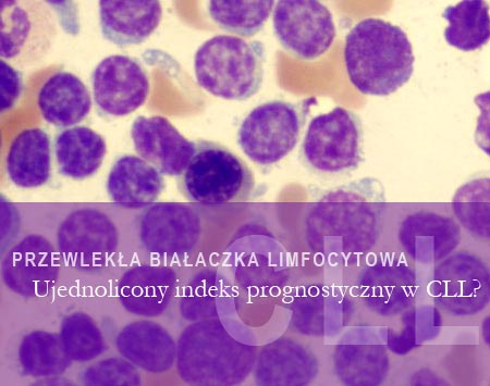 Ujednolicony indeks prognostyczny w CLL?
