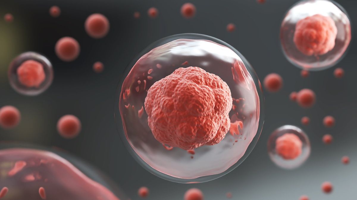 Nowa opcja terapeutyczna w pierwszej linii leczenia agresywnych chłoniaków B-komórkowych...