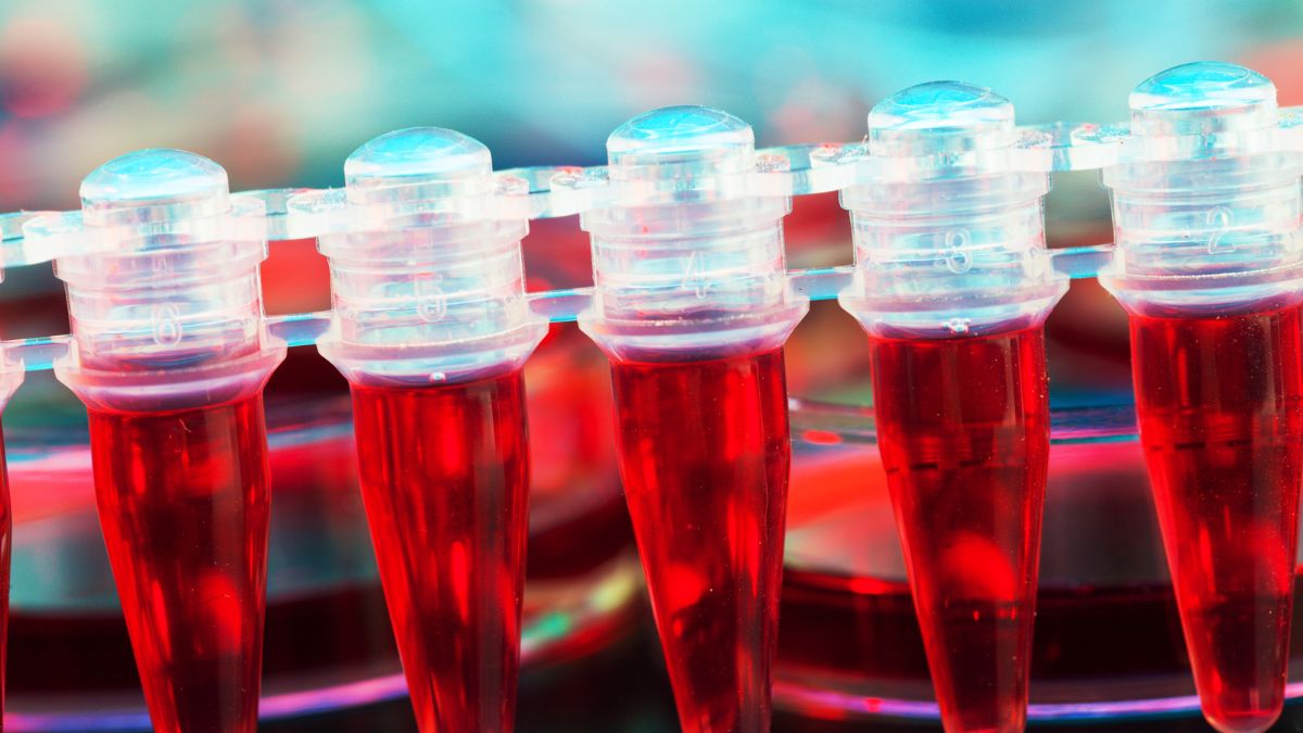 Czym jest hemofilia?