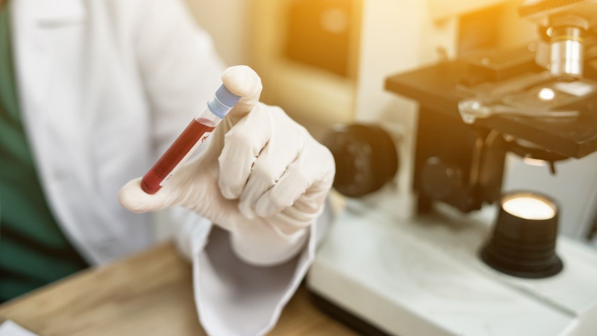 Co oznacza wysoki wynik OB i kiedy powinien nas zaniepokoić?