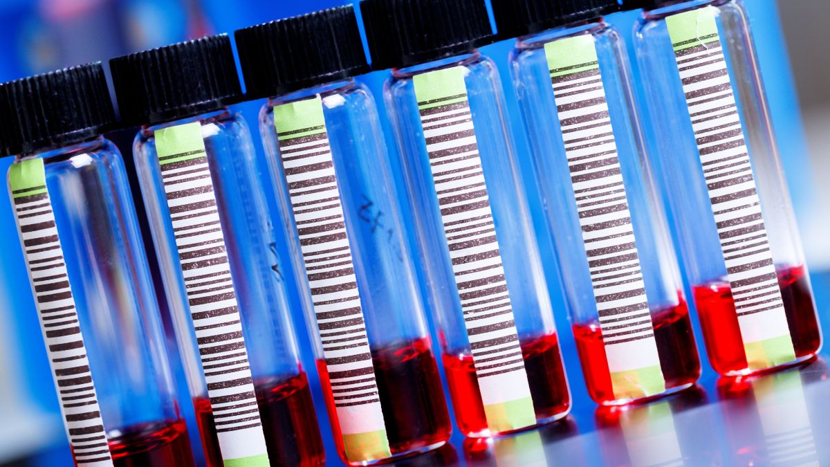 100 lat diagnostyki vWD: od testu kofaktora rystocetyny do badań genetycznych