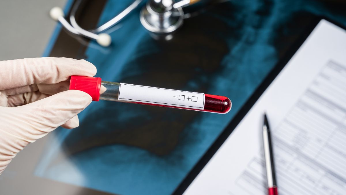 Choroba von Willebranda u kobiet: kiedy miesiączka i poród wymagają szczególnej...