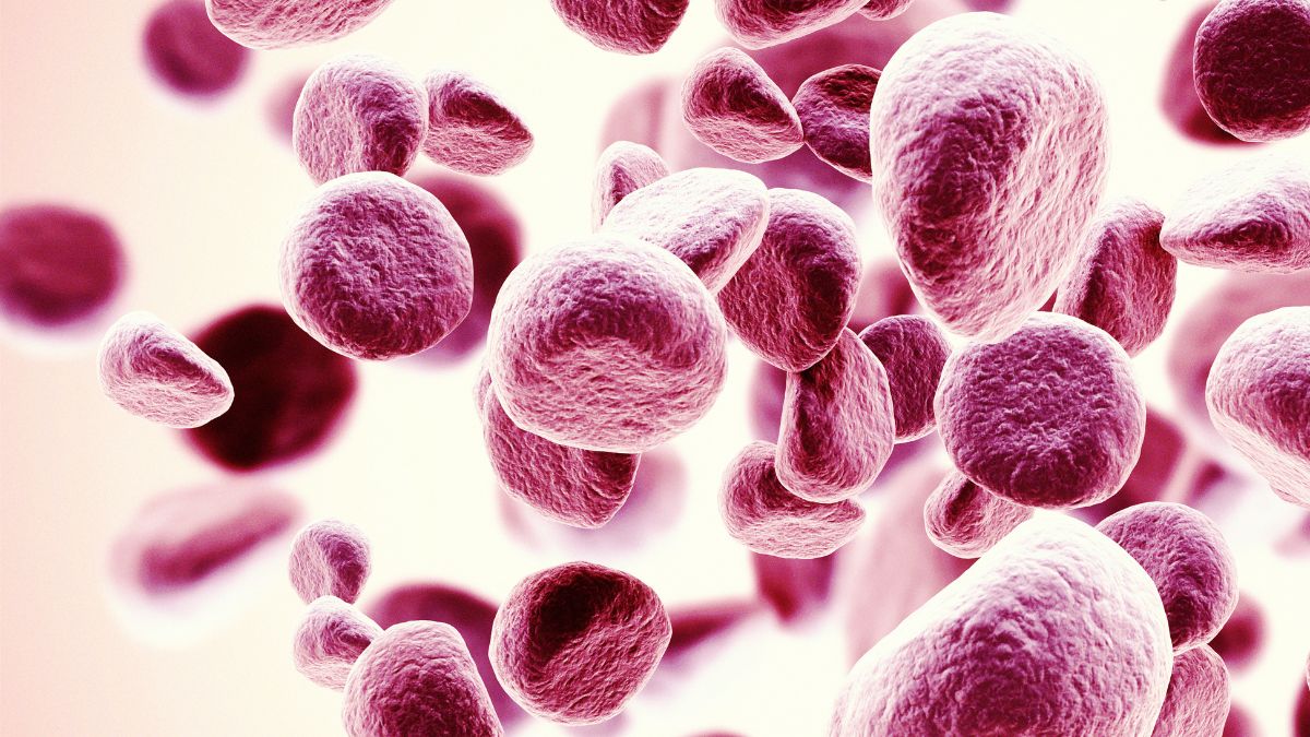 Zmęczenie w PNH – kluczowy, niedoceniany problem