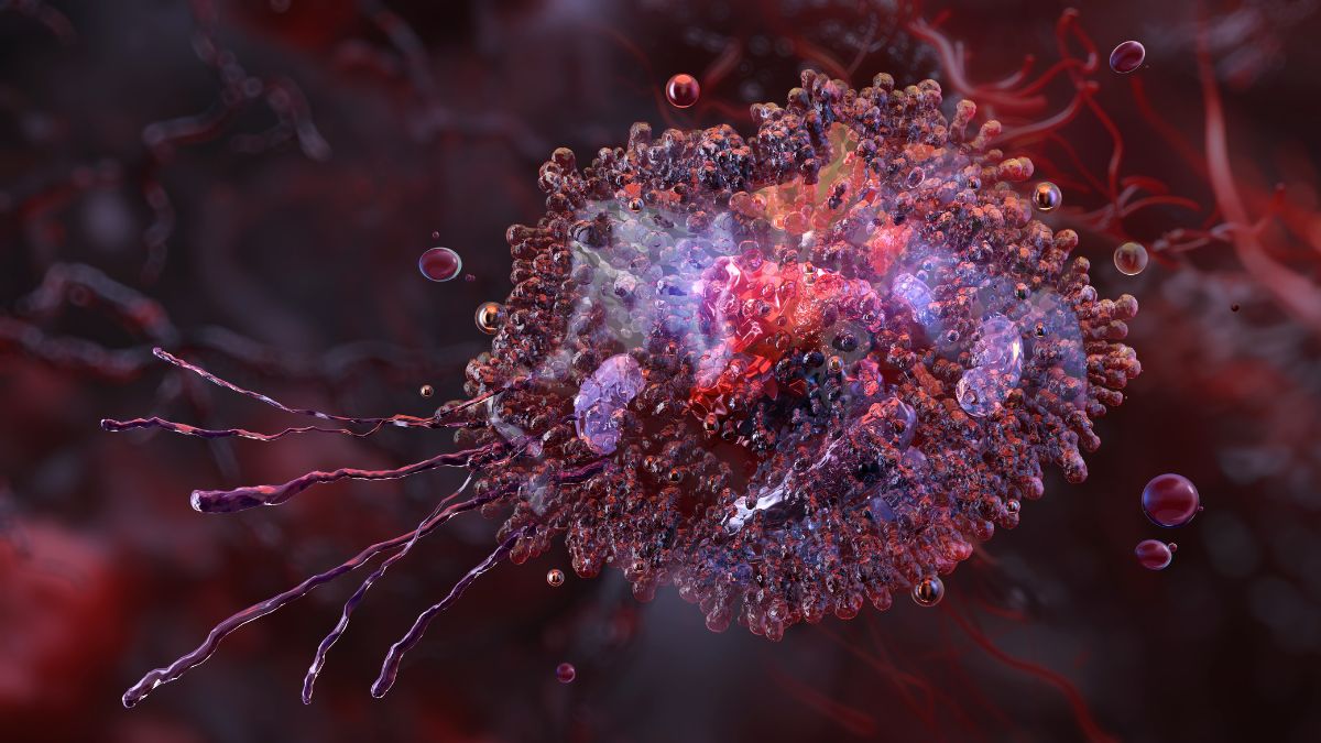 Terapia CAR-T ukierunkowana na CD117 w zaawansowanej mastocytozie układowej