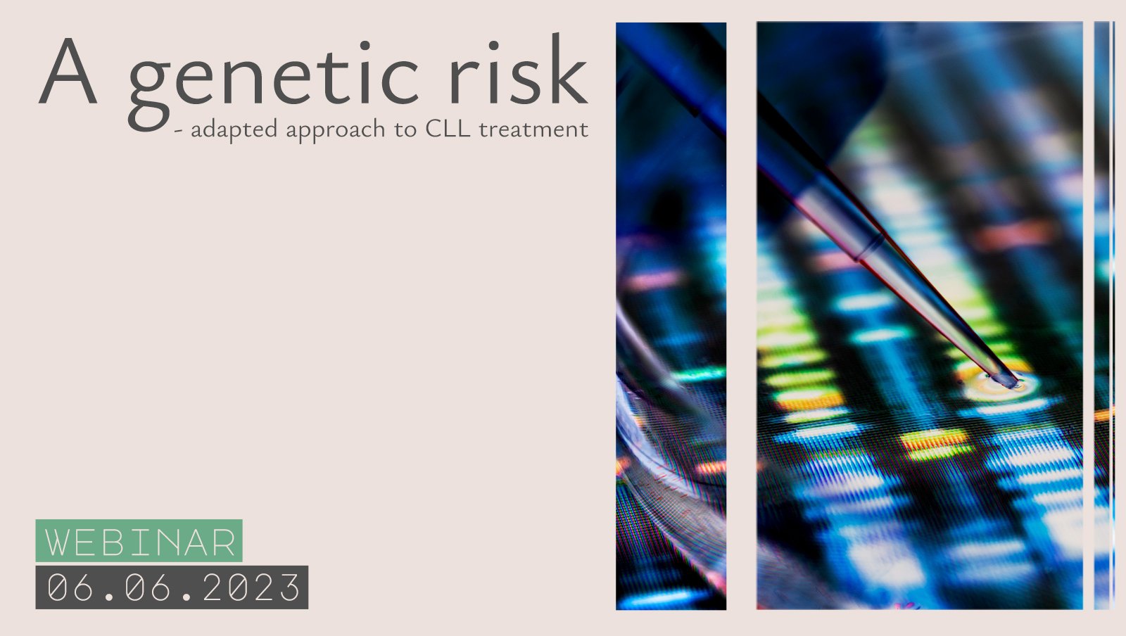 Już dzisiaj webinar: "A genetic risk - adapted approach to CLL treatment"