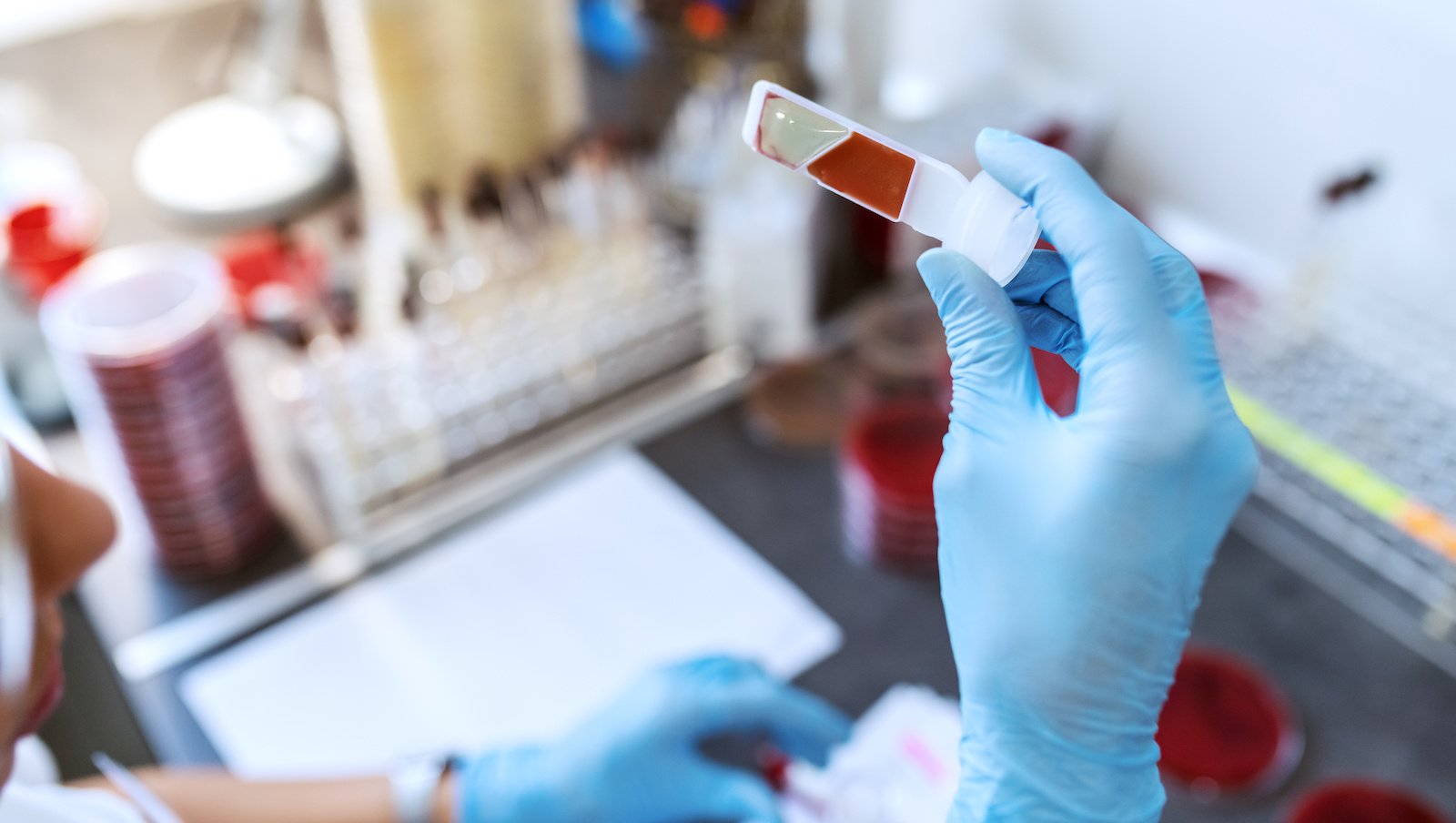 Wenetoklaks z nawitoklaksem w połączeniu z chemioterapią w leczeniu chorych na nawrotową...