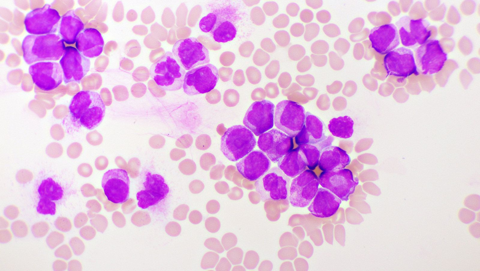 Spotkanie Polskiej Grupy Szpiczakowej | 20.04.2023 r., Wrocław