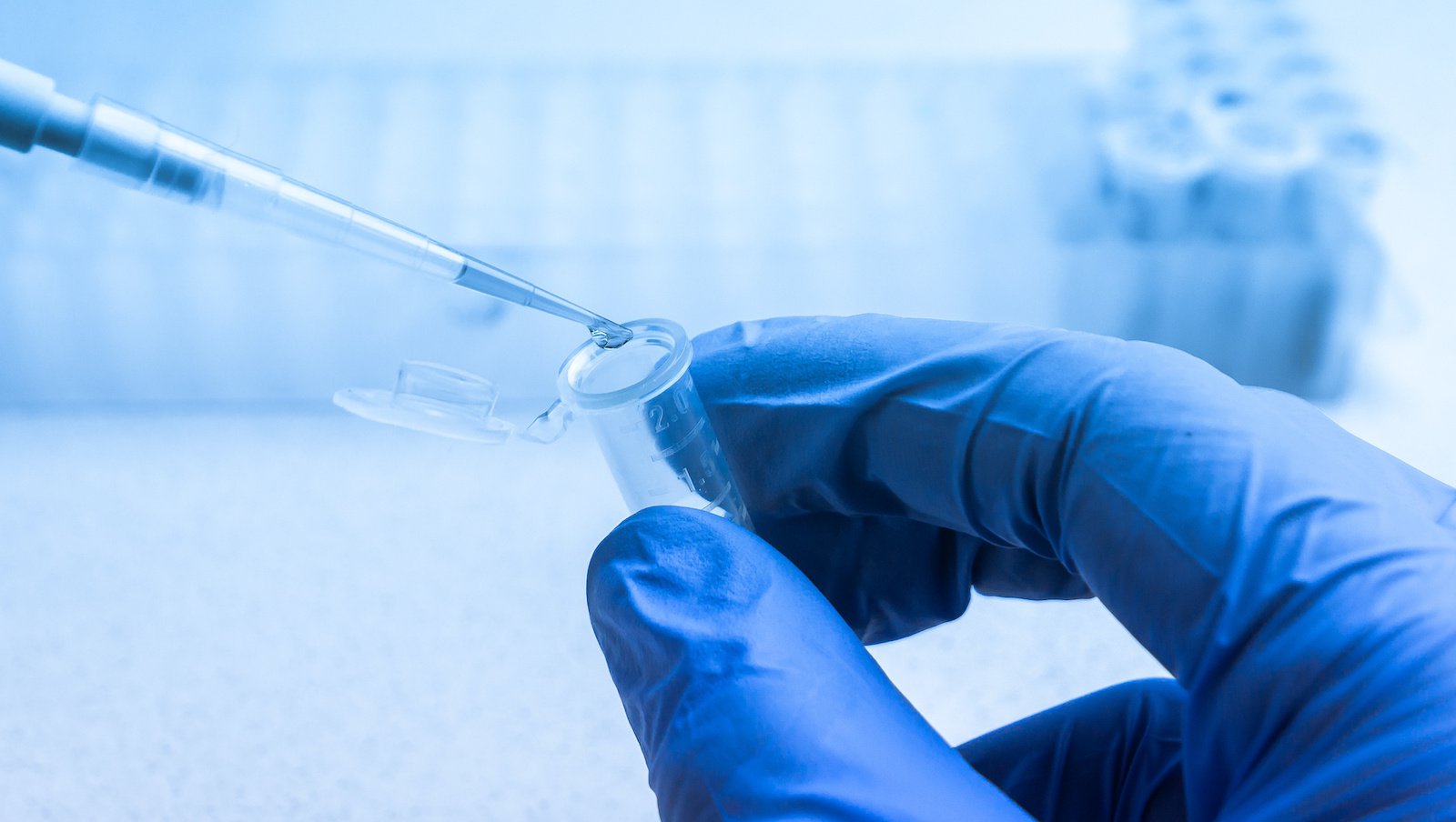 Badanie I/II fazy zmniejszonej dawki cyklofosfamidu (PTCy)  po przeszczepieniu szpiku kostnego w układzie HLA-haploidentycznym