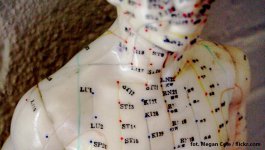 Akupunktura w PN wywołanej bortezomibem i talidomidem