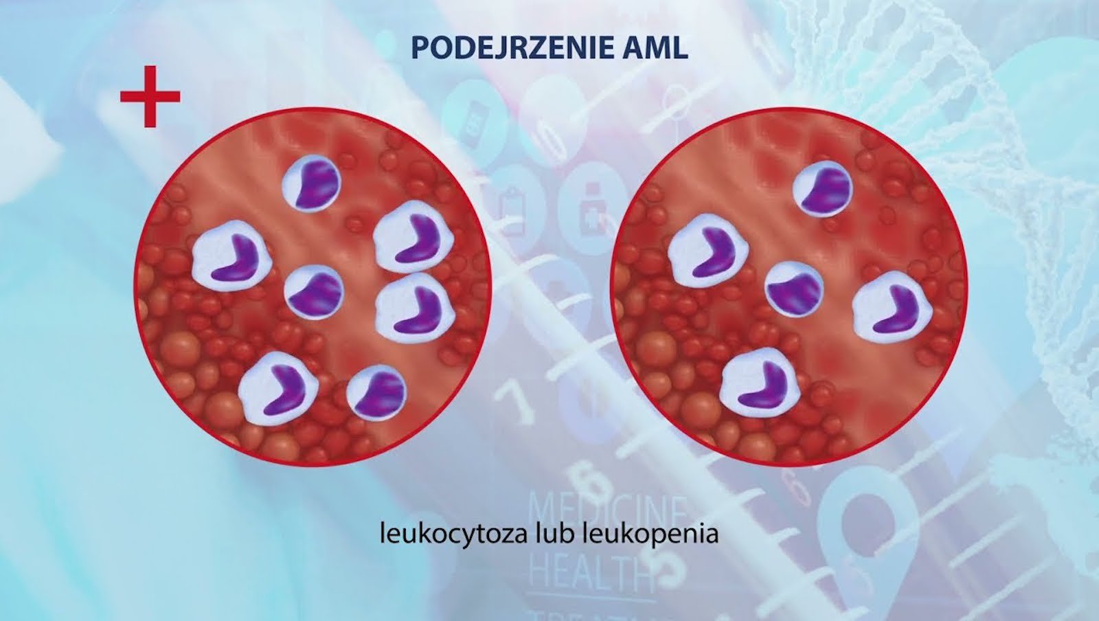 Zapraszamy do obejrzenia edukacyjnych filmów animowanych o ostrej białaczce szpikowej