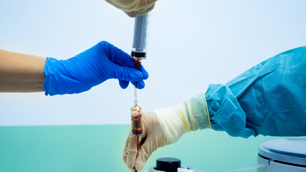 Poprawa wyników przeszczepienia komórek macierzystych wśród pacjentów z AML powyżej...