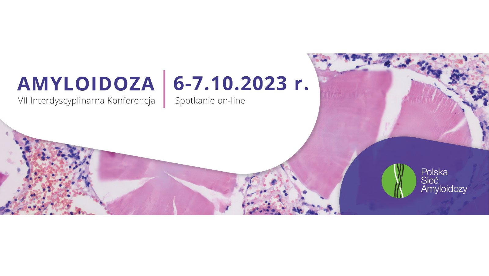 Zaproszenie na VII Interdyscyplinarną Konferencję Amyloidoza | on-line