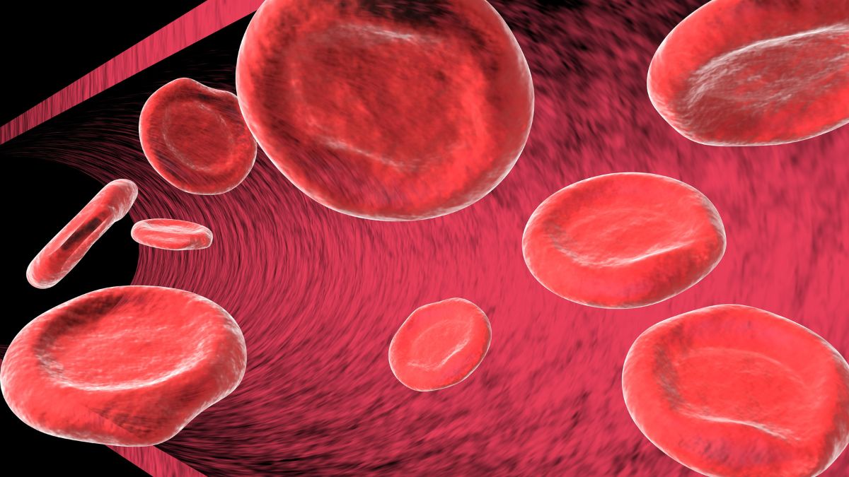 Możliwości leczenia anemii w przebiegu mielofibrozy