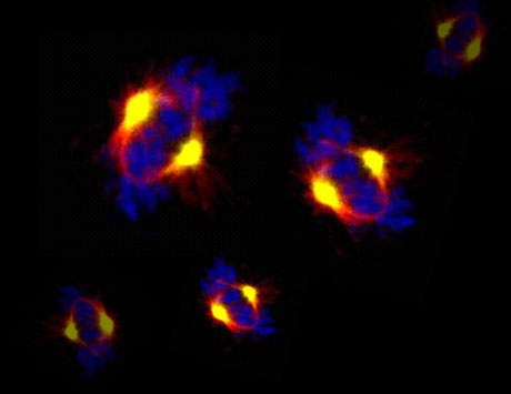 Kinazy Aurora jako potencjalny cel terapii w PBL