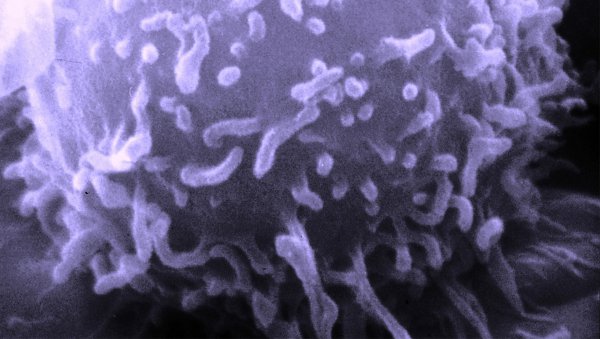 Badania genomiczne DLBCL sugerują wrażliwość komórek nowotworowych na nowe terapie celowane