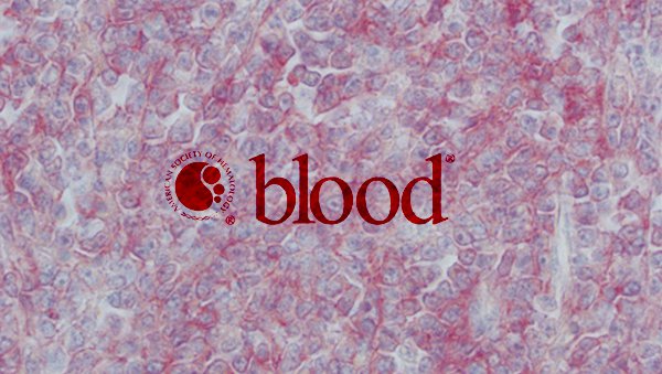 Blood wybrał 10 najlepszych manuskryptów 2016 roku