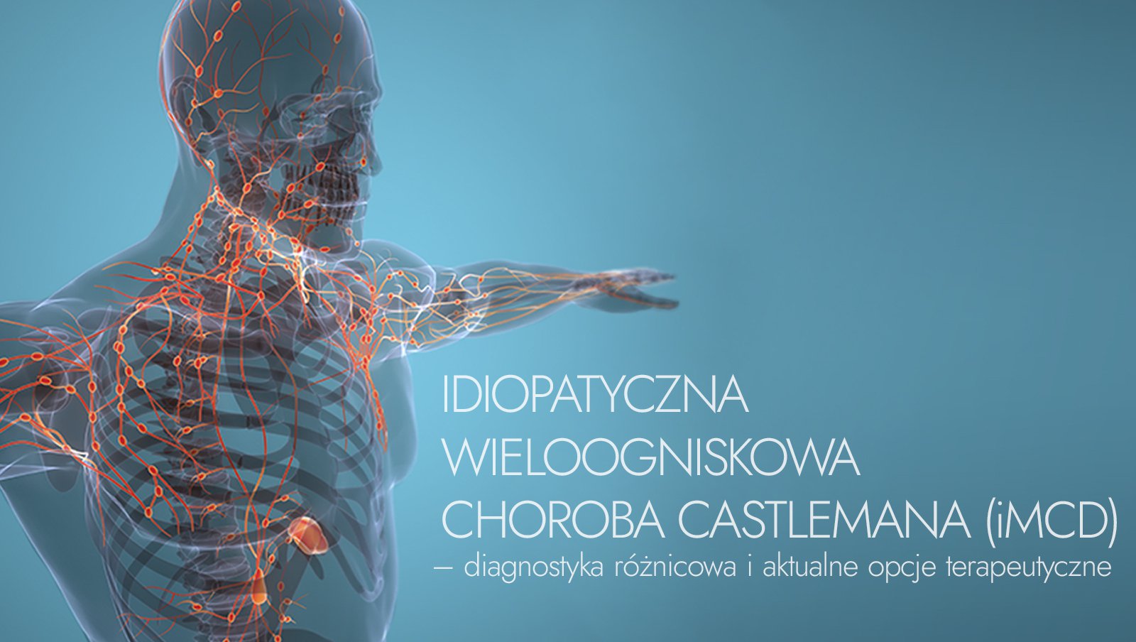 Idiopatyczna wieloogniskowa choroba Castlemana