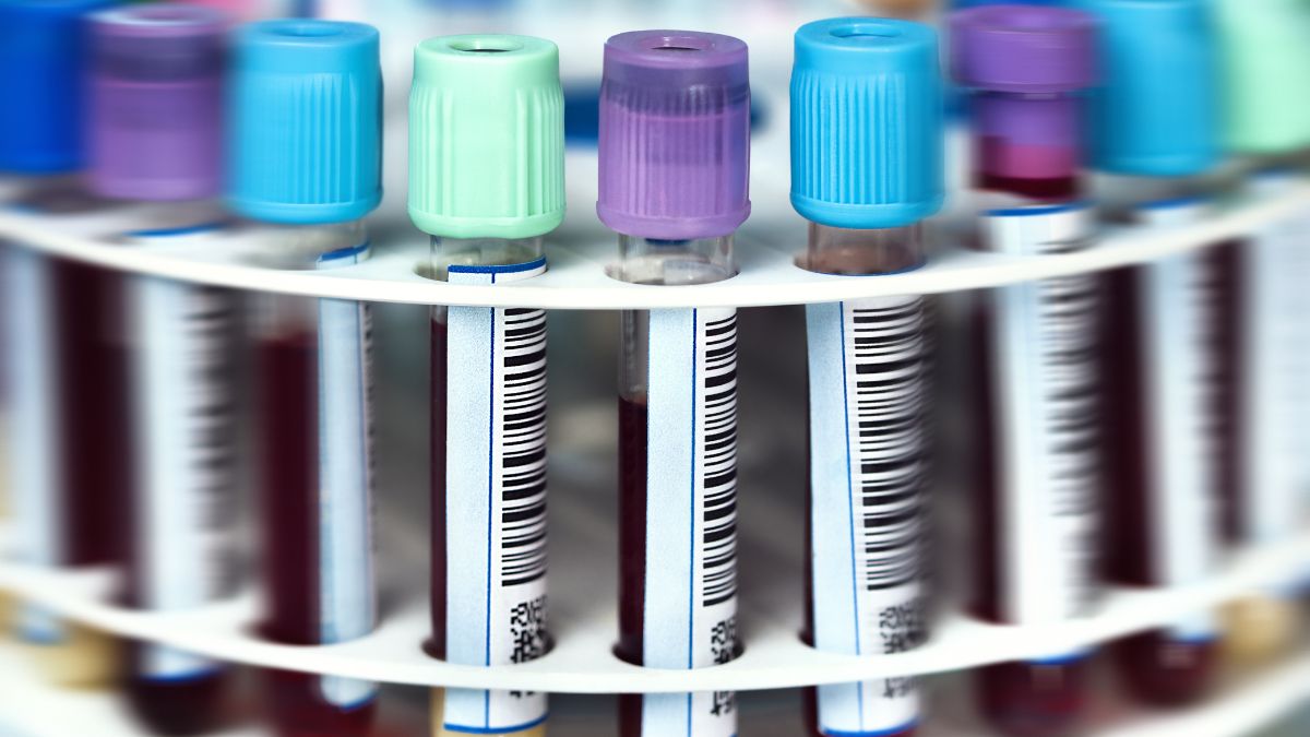 W 2025 roku Chiara Bonini otrzymuje Nagrodę Naukową DKMS im. Mechtild Harf za osiągnięcia...