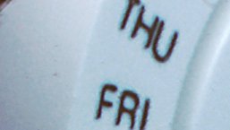 Daratumumab w leceniu opornego szpiczaka