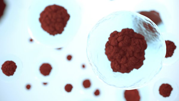 Decyzje transplantacyjne u pacjentów z mielofibrozą: czy mutacje powinny być rozstrzygające