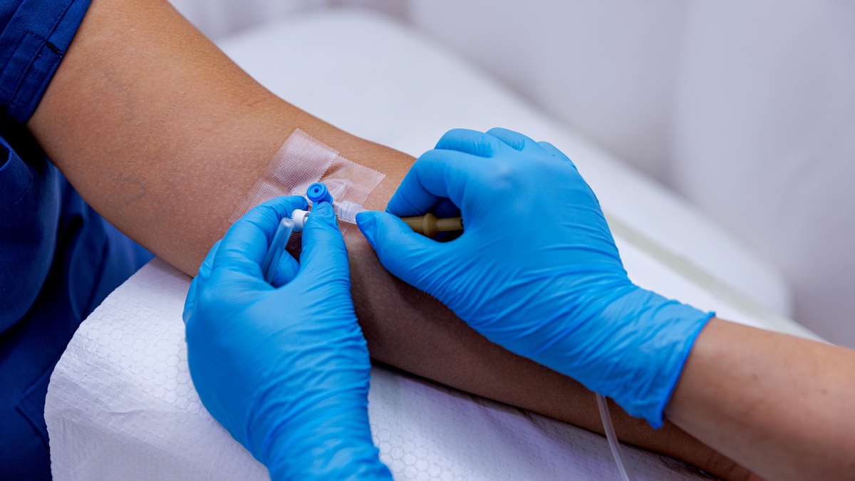 Intensywność dawkowania deksametazonu nie wpływa na wyniki leczenia pacjentów z...