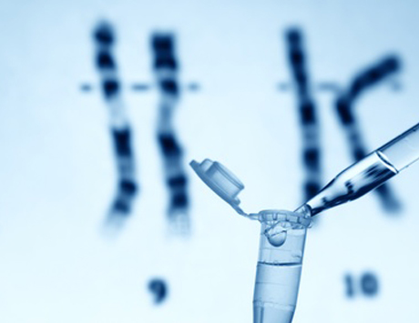 Morfologia szpiku a zaburzenia cytogenetyczne obejmujące min delecję chromosomu 5 u chorych na zespoły mielodysplastyczne
