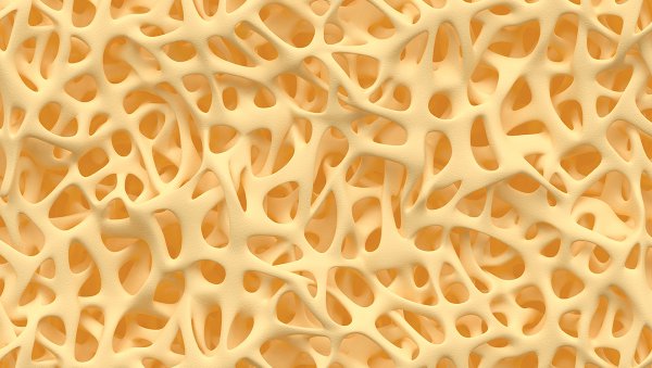 Denosumab vs kwas zoledronowy w terapii zmian kostnych w szpiczaku