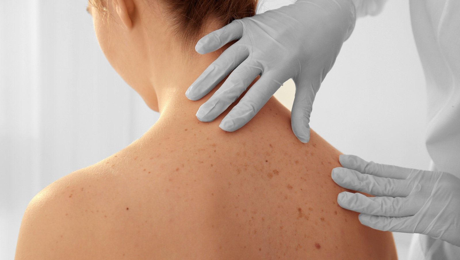 Powikłania dermatologiczne | Mali wielcy ludzie - pierwsze kroki w dorosłość ozdrowieńców...