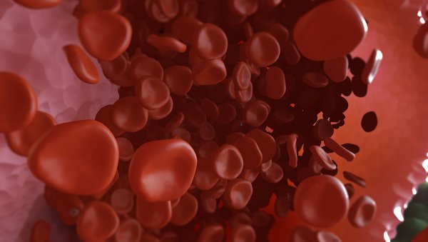 Diagnostyka i leczenie pacjentów z łagodną hemofilią: praktyczne rekomendacje  w...