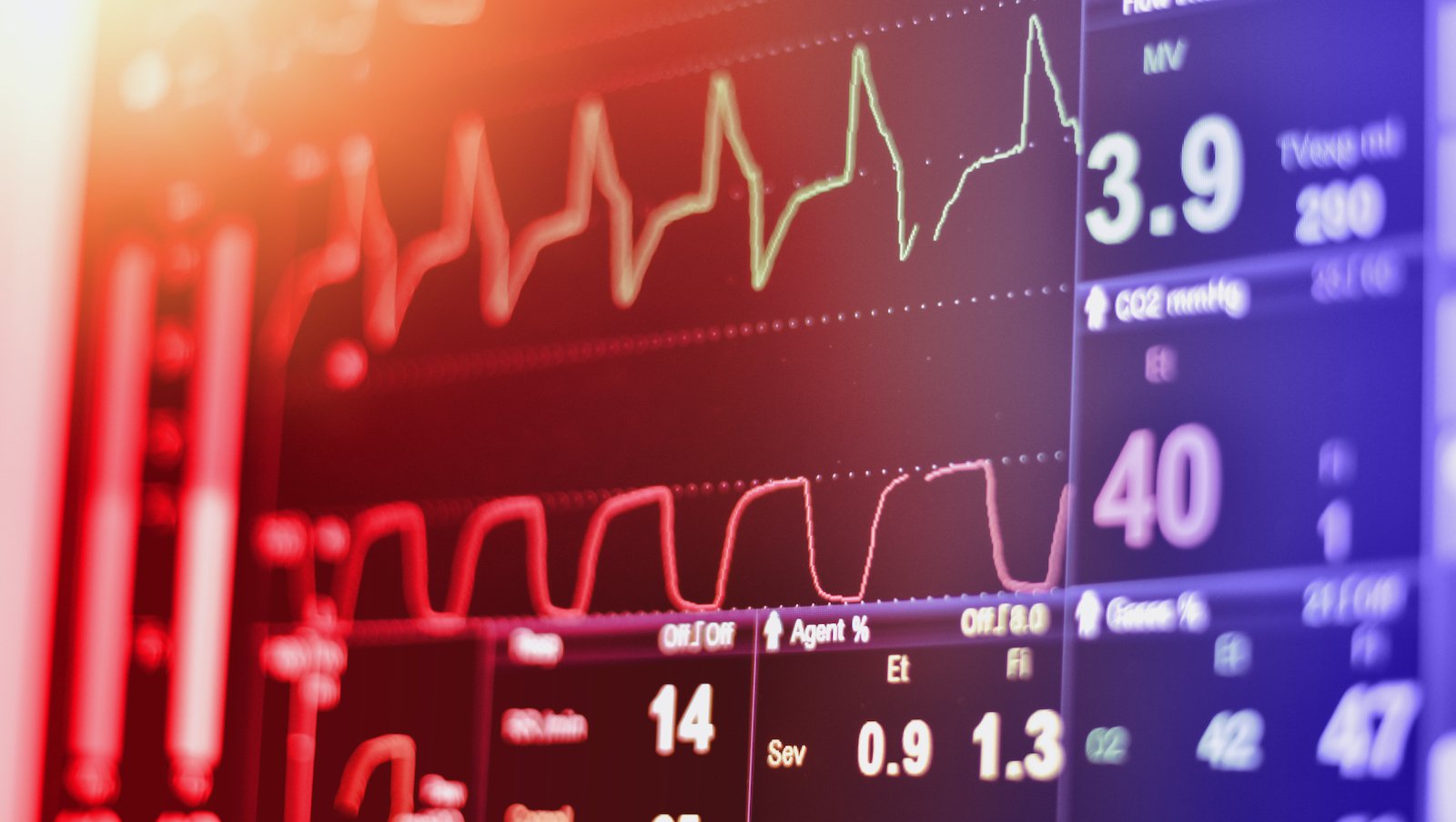 Alert kardiologiczny – pacjent unfit z AML leczony wenetoklaksem w połączeniu z...