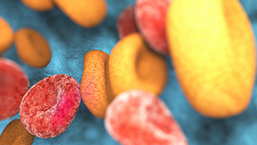 Ewolucja metod leczenia makroglobulinemi Waldenströma i ich wyników na podstawie...